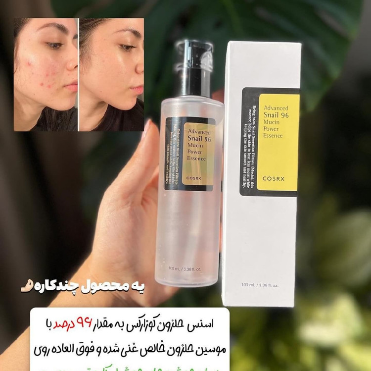 پوست خانمی قبل و بعد از استفاده از سرم حلزون کازرکس