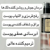 ویژگی های کرم حلزون کازرکس